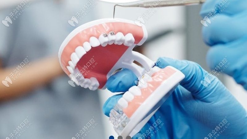 根尖手术：揭秘其适应症与重要性**